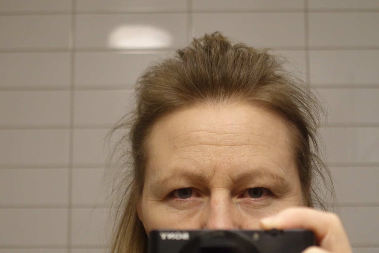 Hur Ser Man Att En Propp Har Gått
